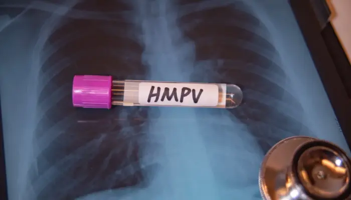 HMPV: Symptoms, Transmission, and Prevention